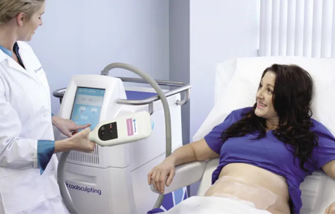 What Happens During the CoolSculpting Session?